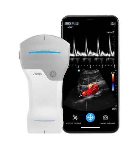 Vscan Air GE (Linear + Convex)